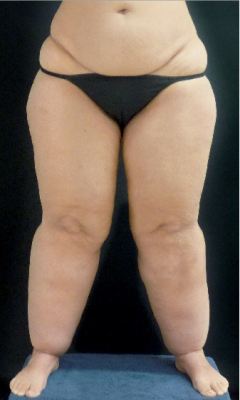 Ausgangssituation Ausgangssituation