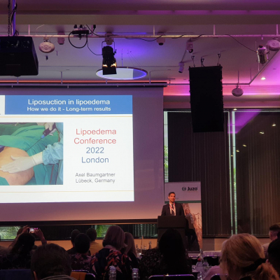 Lipoedema Conference London 2022 2