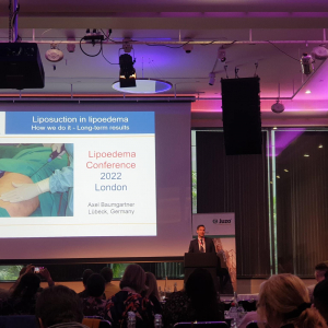 Lipoedema Conference London 2022 2